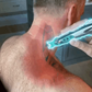 Acupunctuur pen voor spiermassage