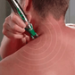 Acupunctuur pen voor spiermassage